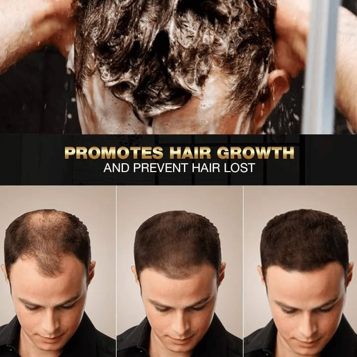 💥2024 New Hair Darkening Shampoo Soap - Hair Turns Black - Prevent Hair Loss - Nourishes Hair Growth