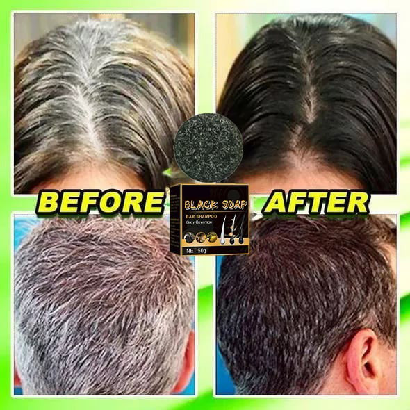 💥2024 New Hair Darkening Shampoo Soap - Hair Turns Black - Prevent Hair Loss - Nourishes Hair Growth