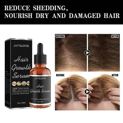 💥Big Discount Today - 2024 New 🔥Allurium Hair Growth Serum — See Results In 14 Days (or less)