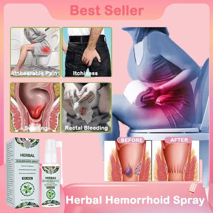 💥2024 Experts Recommend Product - New Upgraded Formula Herbal Hemorrhoids Spray【Permanent Removal & No Recurrence】