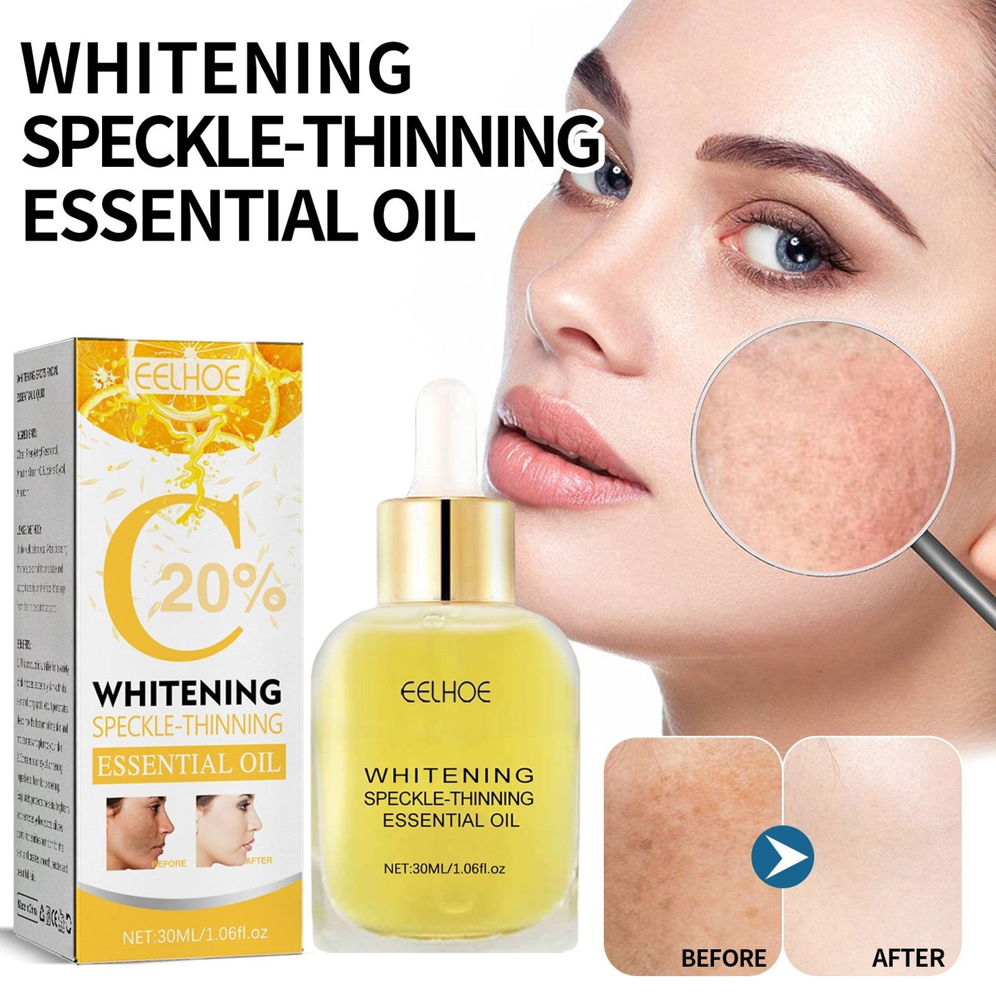 💥Big Discount Today - 2024 New Upgraded Formula - Whitening Speckle Thinning Essential Oil