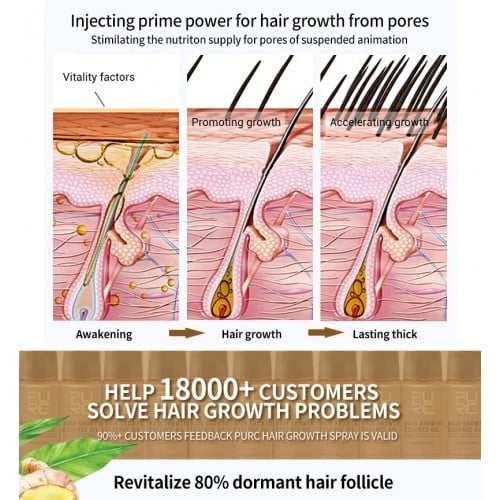 💥2024 New Hair Growth Spray - Fast Hair Growth - Prevent Hair Loss