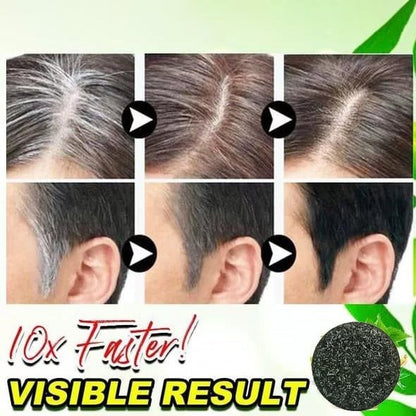 💥2024 New Hair Darkening Shampoo Soap - Hair Turns Black - Prevent Hair Loss - Nourishes Hair Growth